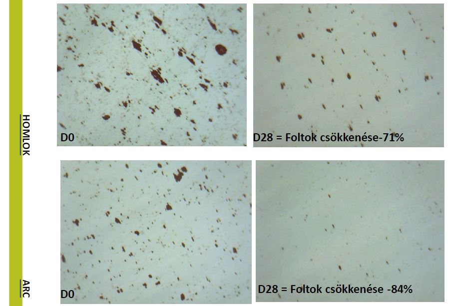 algopure klinikai teszt, algotherm