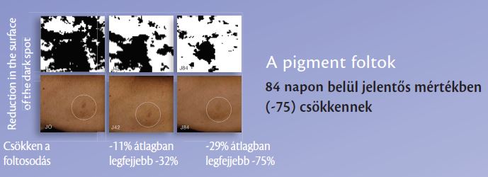 Algotherm, professzionális kozmetikum, ragyogó bőr, egységes bőr, pigmentfolt, pigmentfolt ellen