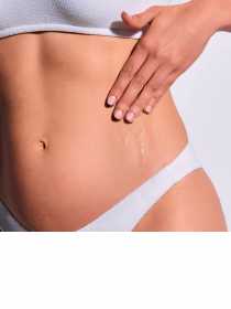 Feszesítő Száraz Olaj a striák ellen 100 ml